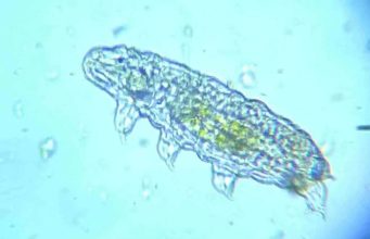 Are Tardigrades Dangerous? Are Tardigrades Dangerous