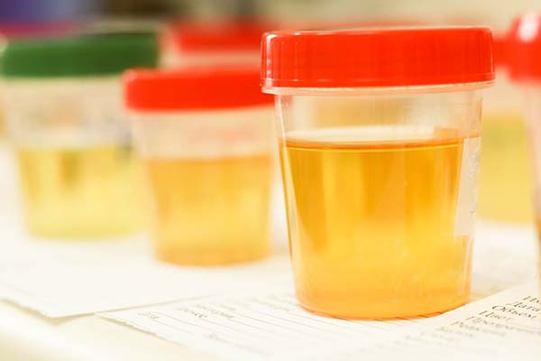 Can I Use A Urine Sample From A Different Gender To Pass My Drug Test