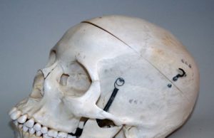 How Much Pressure To Break A Skull? How Much Pressure To Break A Skull