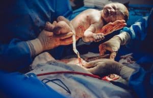 What Can Be Done To Minimize The Risk Of Birth Injuries What Can Be Done To Minimize The Risk Of Birth Injuries