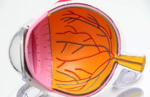 How Do You Treat Diabetic Macular Edema? How Do You Treat Diabetic Macular Edema