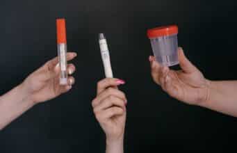 How Long After Taking Azo Can I Take A Urine Test: Timing For Urine Tests How Long After Taking Azo Can I Take A Urine Test